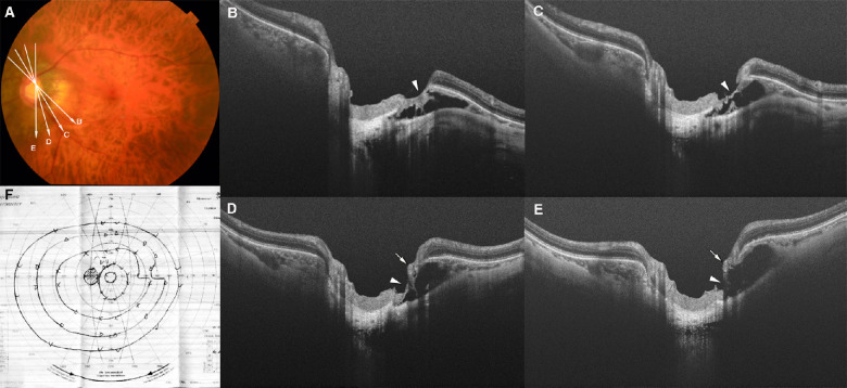 Figure 5.