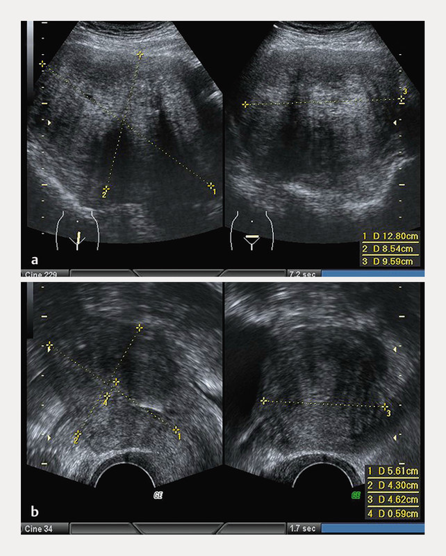 Fig. 2