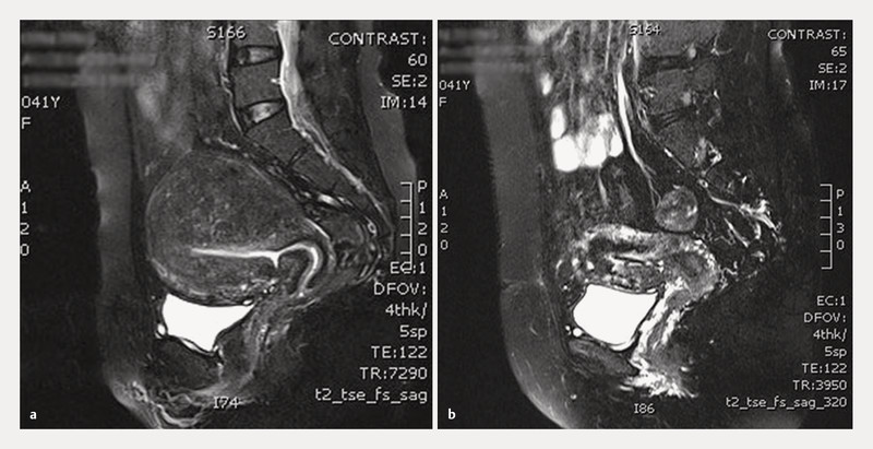 Fig. 3