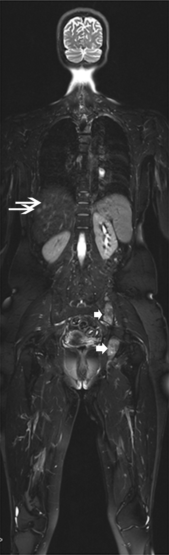 Figure 6: