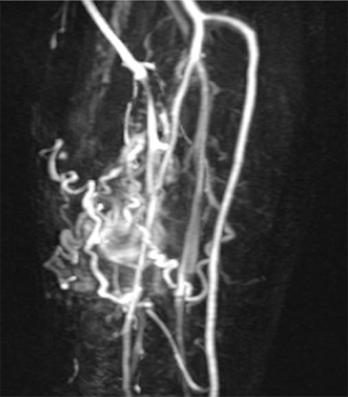 Figure 7d: