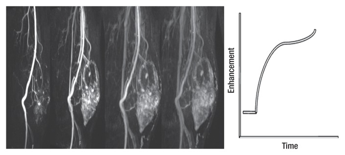 Figure 5b: