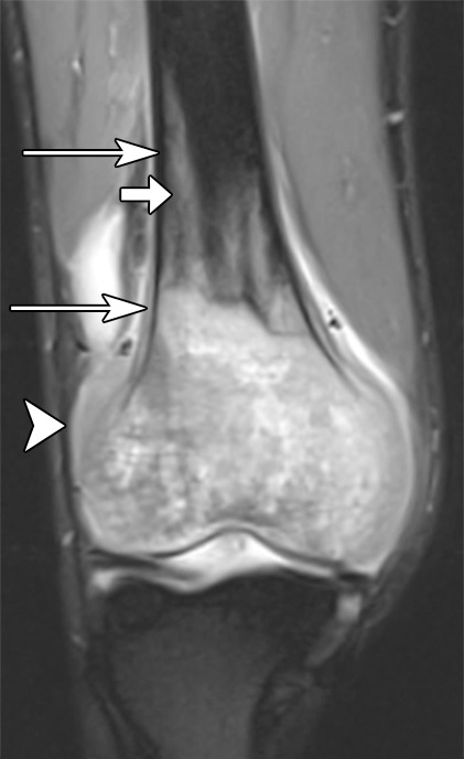 Figure 1b: