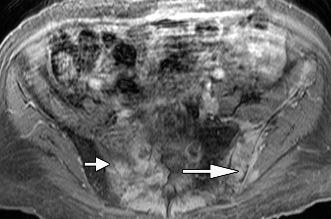 Figure 3b: