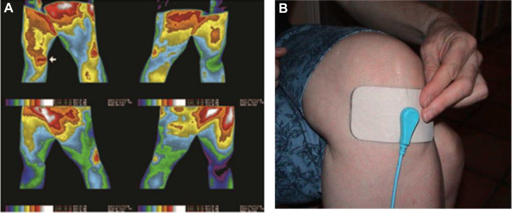 Fig. 4