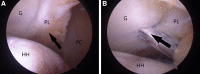 Fig 9