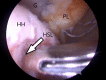 Fig 10