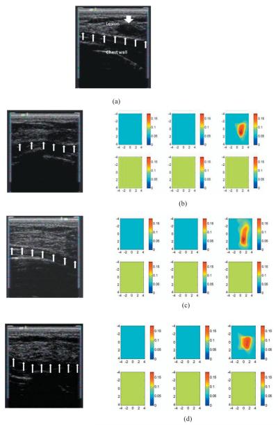 Fig. 14