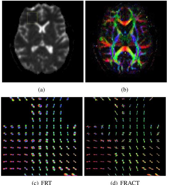 Figure 15