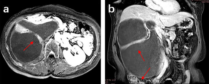 FIGURE 3