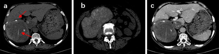 FIGURE 1