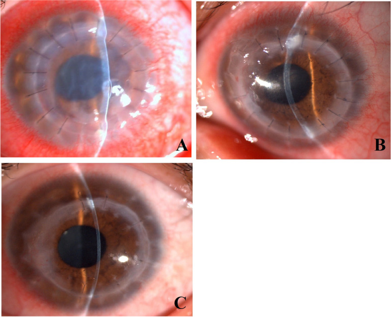 Fig. 2