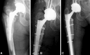 Fig. 4A–C