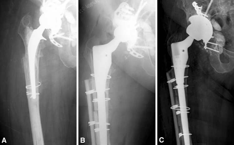 Fig. 3A–C