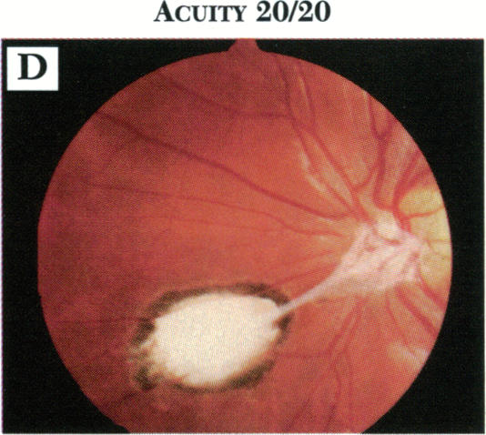 FIGURE 20D