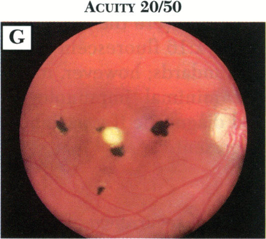 FIGURE 20G