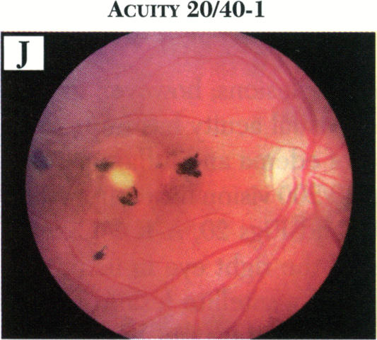 FIGURE 20J