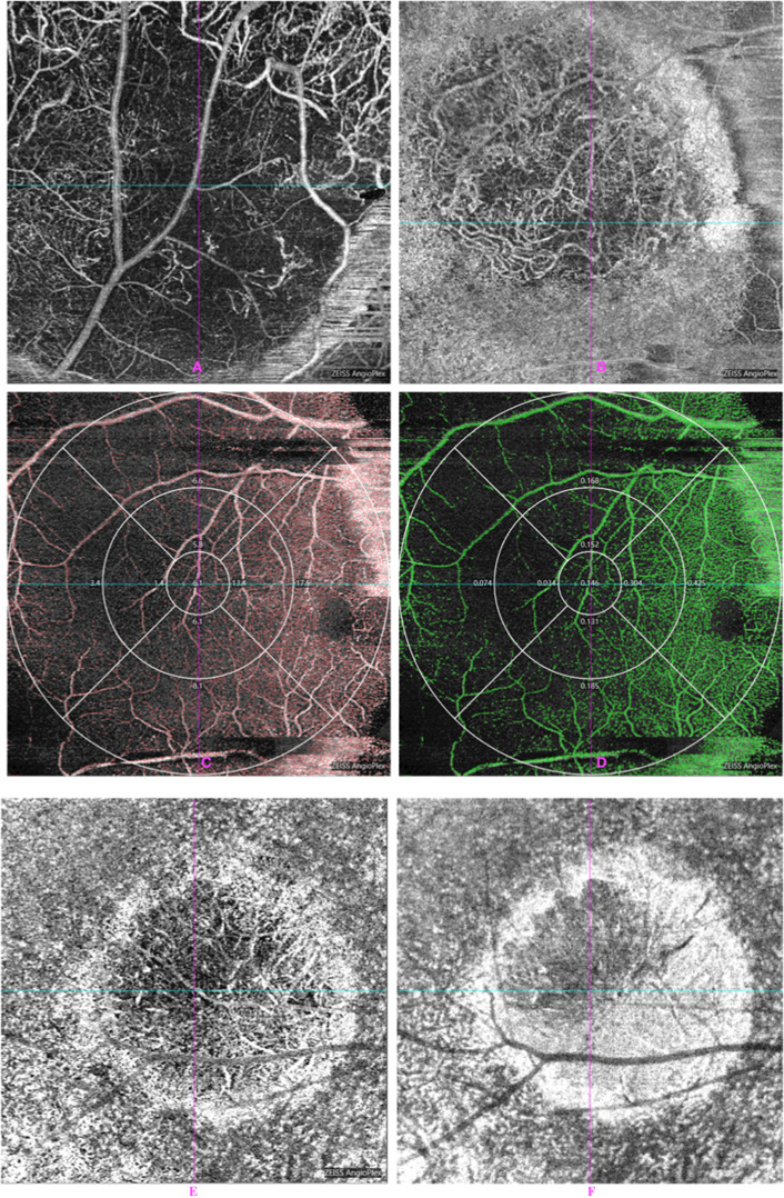 Fig. 2