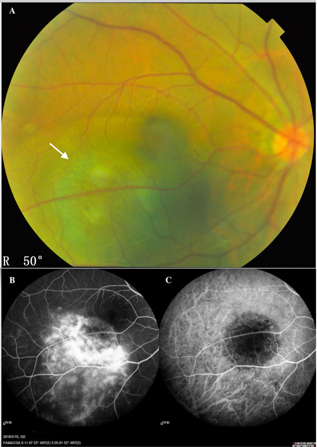 Fig. 1