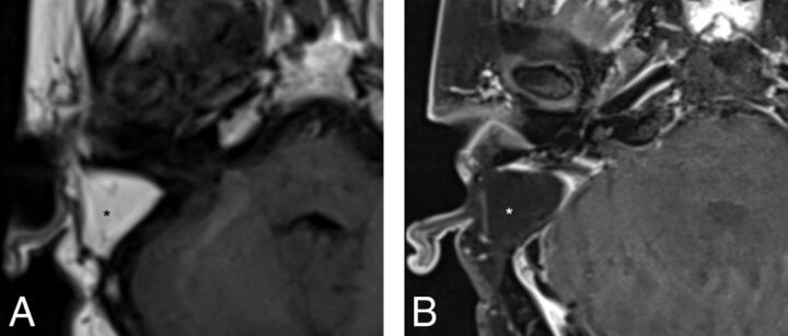 Fig 2.