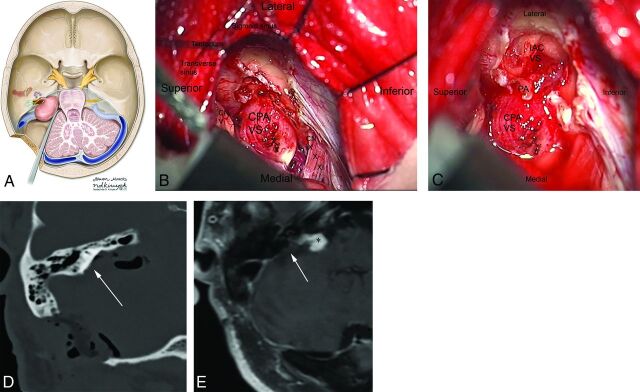 Fig 3.