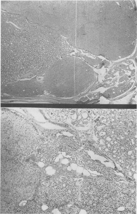 Fig. 6 (Upper)., Fig. 7 (Lower).