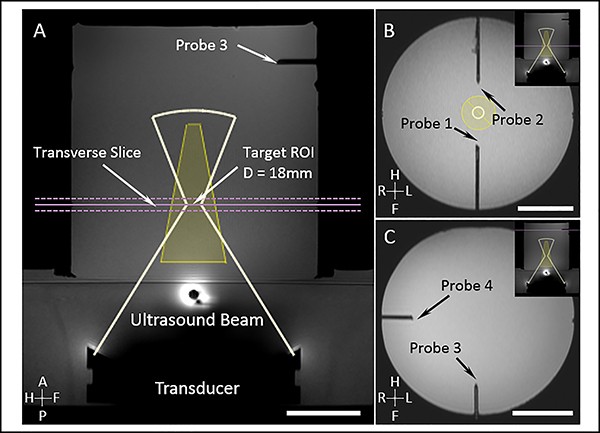 Fig.2