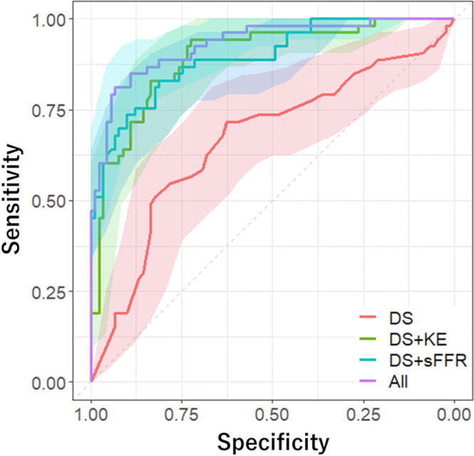 Comparison of receiver operating characteristic curves to predict hemodynamically significant stenosis. The areas under the receiver operating characteristic curve (AUCs) of models 1–4 were as follows: model 1 (diameter stenosis [DS]), 0.67 (95% CI: 0.57, 0.76); model 2 (DS, kinetic energy [KE]), 0.89 (95% CI: 0.84, 0.95); model 3 (DS, simulated fractional flow reserve [sFFR]), 0.89 (95% CI: 0.84, 0.95); and model 4 (DS, KE, sFFR), 0.93 (95% CI: 0.89, 0.97). There were significant differences between models 1 and 2 (P < .001) and models 1 and 3 (P < .001), with no evidence of a difference between models 2 and 3 (P = .99). The AUC in model 4 was significantly higher than those in model 2 (P = .02) and model 3 (P = .04). Shaded areas represent 95% confidence band.