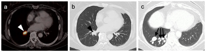 Figure 42