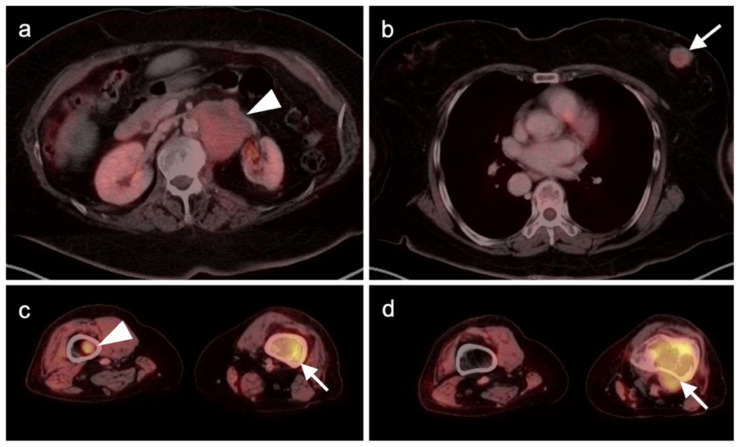 Figure 16