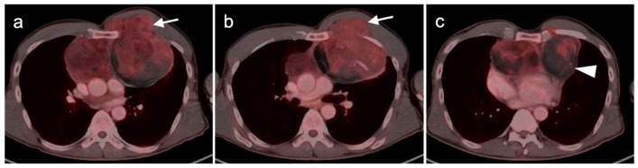 Figure 23