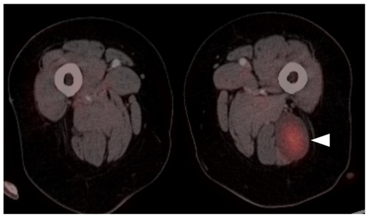 Figure 28