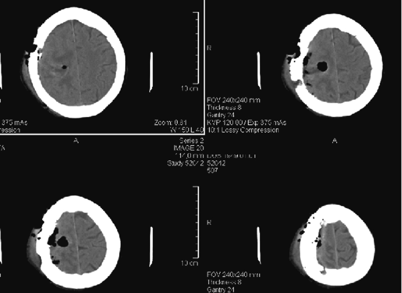 Fig. 4