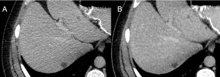 Fig. 8