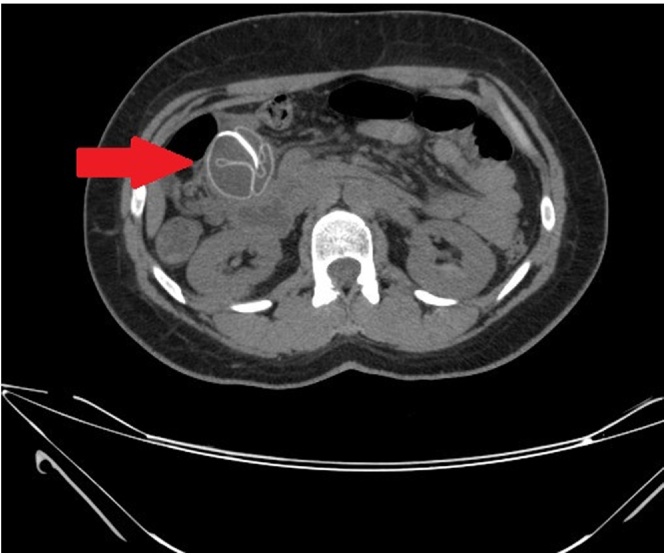 Fig. 1