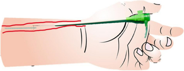 Fig. 1