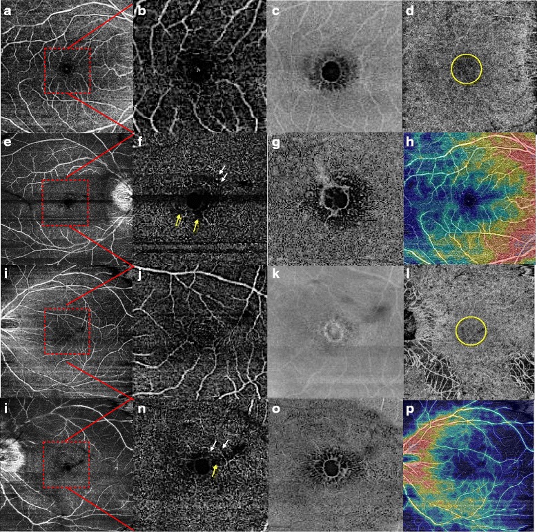 Fig. 2