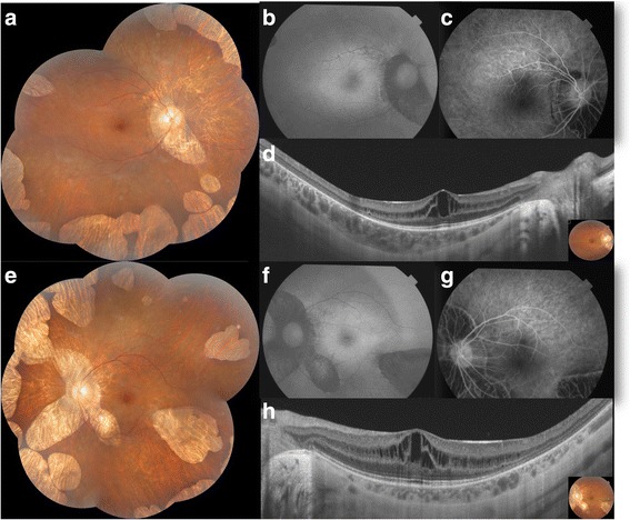 Fig. 1