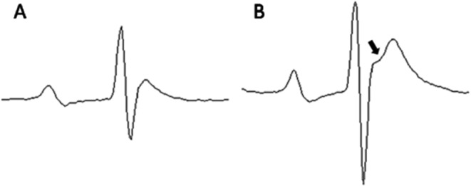 Fig. 2.