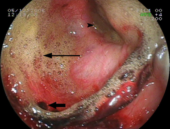 Fig 3