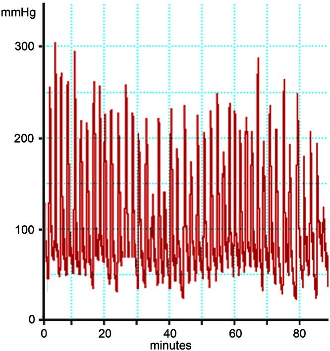 Fig. 11