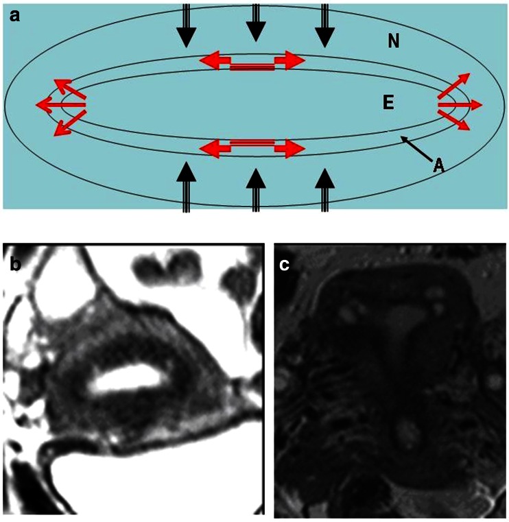 Fig. 12