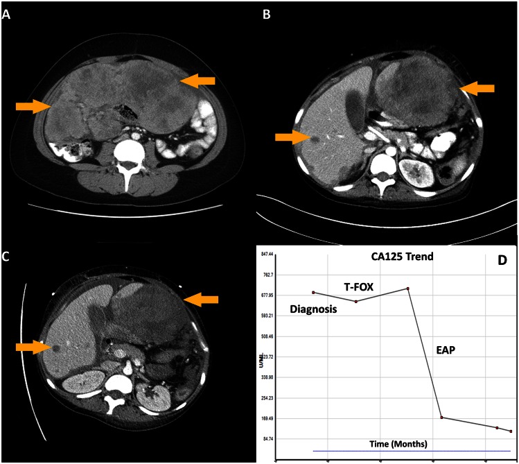 Fig 3