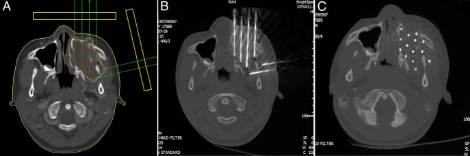 Fig. 4.