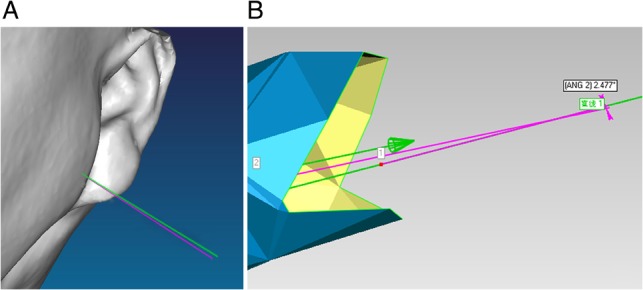 Fig. 6.