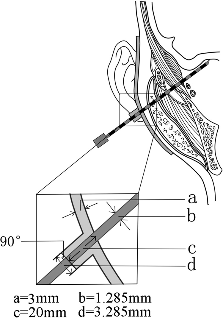 Fig. 2.