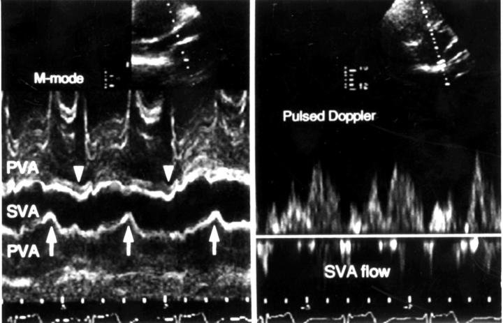 Figure 4  