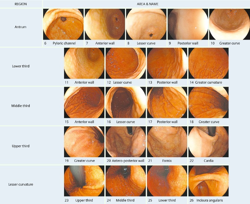 Fig. 1