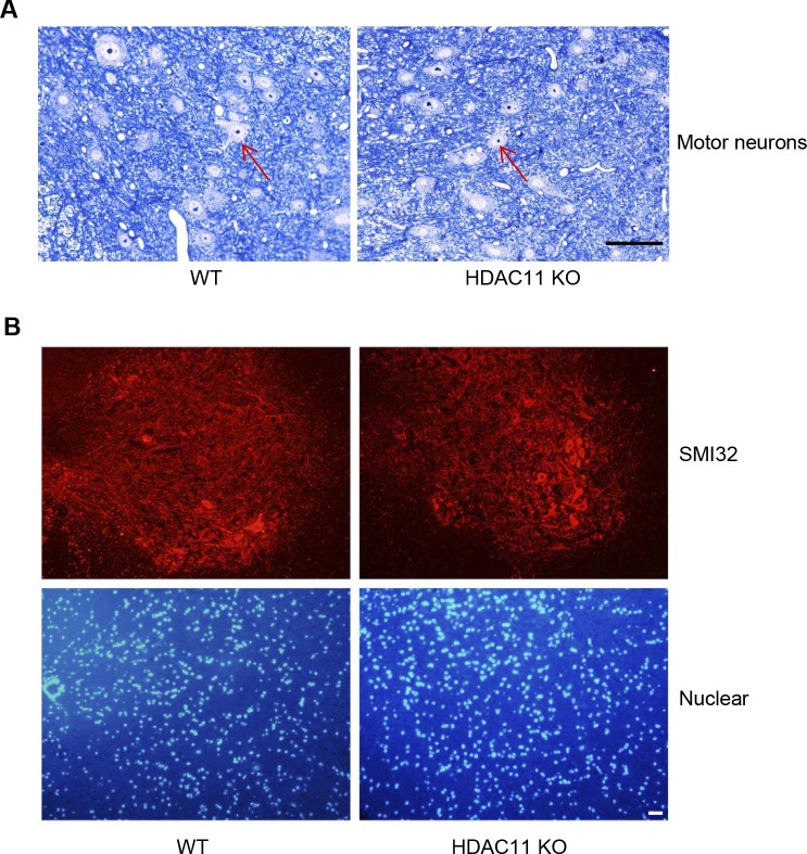 Figure S4. Motor neurons in EAE mice.