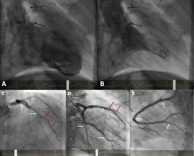 Fig. 2